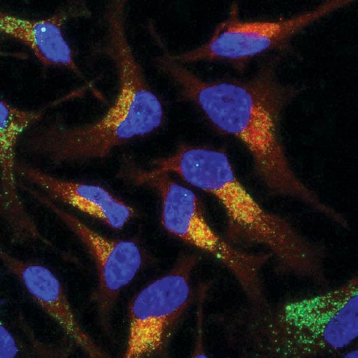 Co-localization of an antisense oligonucleotide (ASO) using Immunoflourescence Microscopy